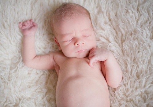 Trīs jautājumi par jaundzimušā ādu