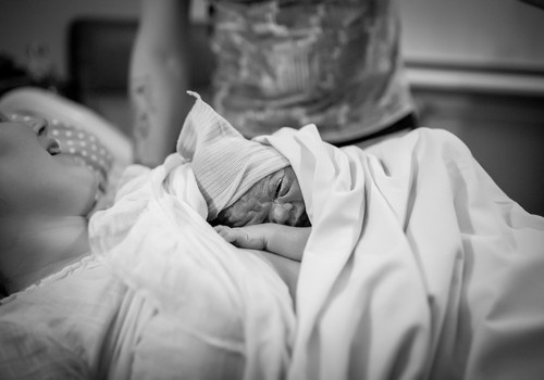 O-o-o- kad dzemdībās jāsastopas ar negaidīto jeb liekam lietā B plānu
